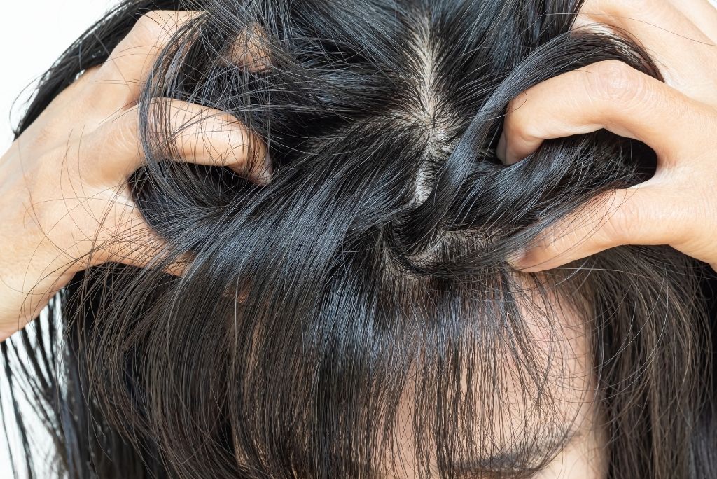 rockene Kopfhaut vs Schuppen Unterschiede und Behandlungsansatze