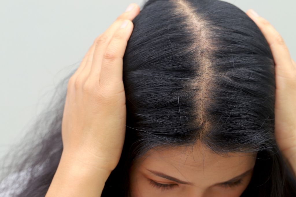 Dunner werdendes Haar Ursachen Behandlung und Pravention