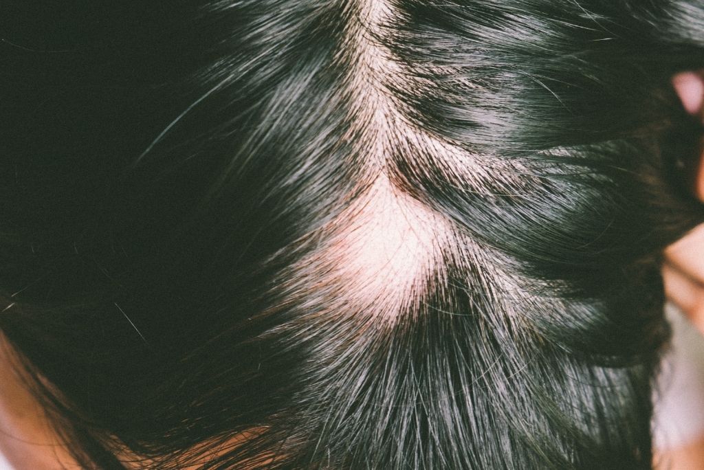 Trockene Kopfhaut Wir beantworten die am haufigsten gestellten Fragen