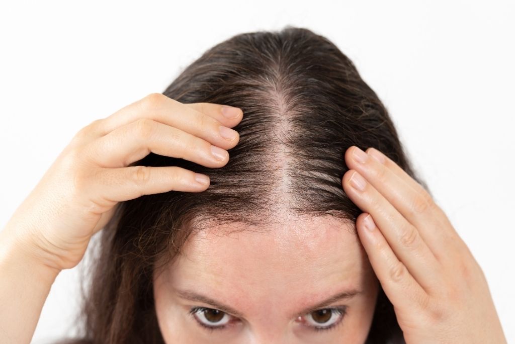 Entzundete Kopfhaut besanftigen_ Die heilende Kraft der Weidenrinde